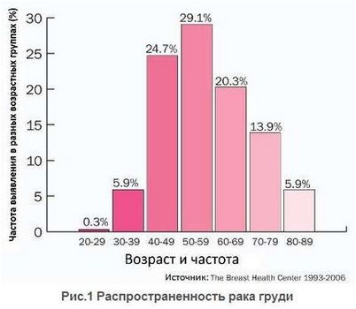 молочной железы