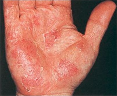 зерновых культур