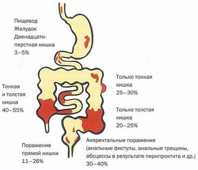 силу того силу того