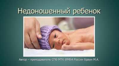 Недоношенные дети могут столкнуться с длительным риском анестезии Недоношенные дети могут столкнуться с длительным риском анестезии
