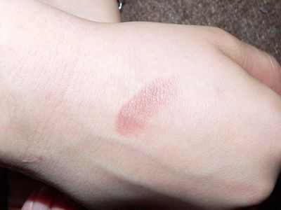 AAD: изменения кожи могут быть первым признаком основного заболевания